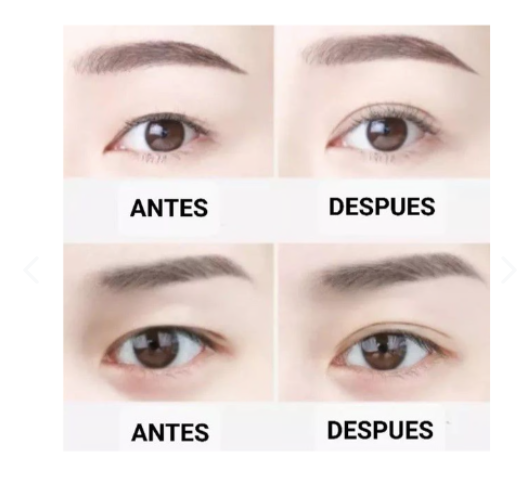 Cinta Ajustadora de Párpados