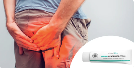 Crema Herbal hemorrhoid