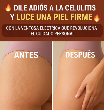 BodyFit Therapy – Ventosa Eléctrica Terapéutica 3 en 1