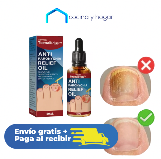Vitaluñas - Uñas Sanas, Seguras y Sin Hongos
