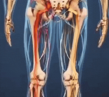 Parche Sciatica (Paquete x12)