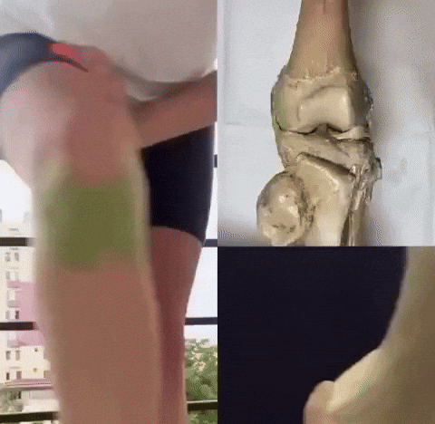 Flex A- Parches de alivio de Rodilla (Paquete x 12)