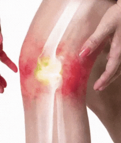 Lumbartrin: Alivio Inmediato al Dolor