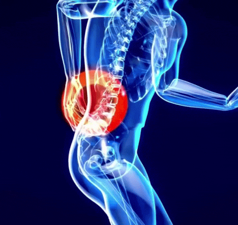 Parche Sciatica (Paquete x12)