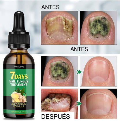 UñaSana™ – Reparador Intensivo de Uñas y Onicomicosis