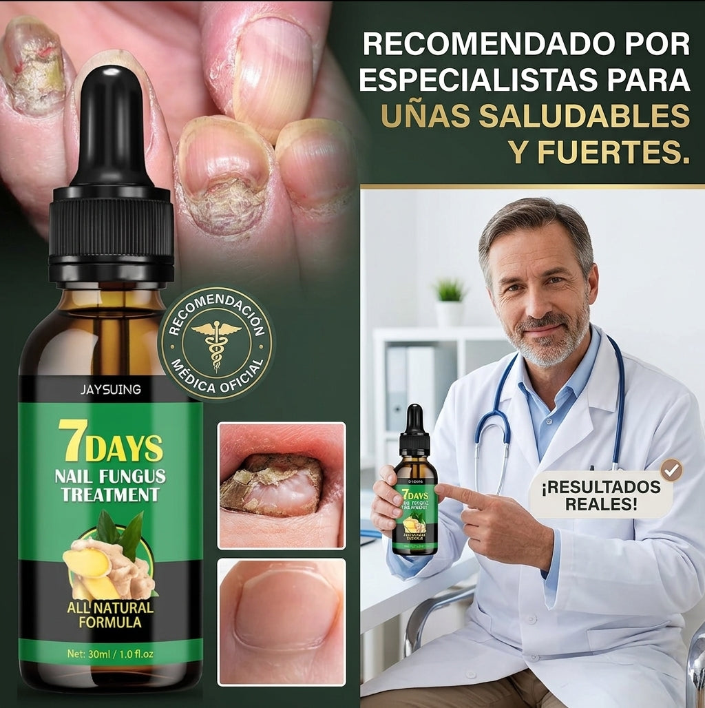 UñaSana™ – Reparador Intensivo de Uñas y Onicomicosis