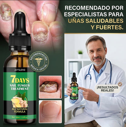 UñaSana™ – Reparador Intensivo de Uñas y Onicomicosis