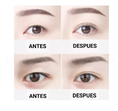 Cinta Ajustadora de Párpados