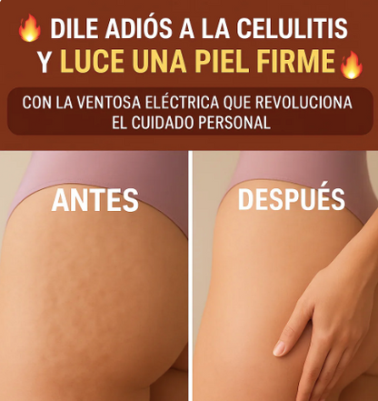 BodyFit Therapy – Ventosa Eléctrica Terapéutica 3 en 1