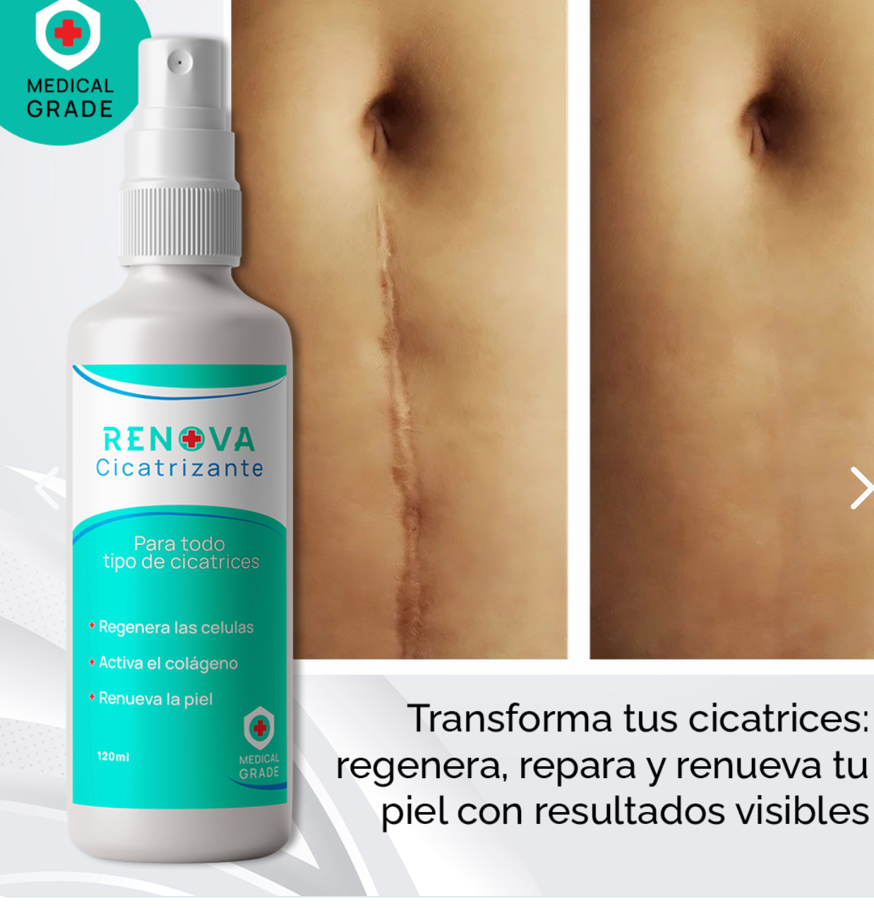 RenovaDerm Spray – Cicatriza Rápido y Natural