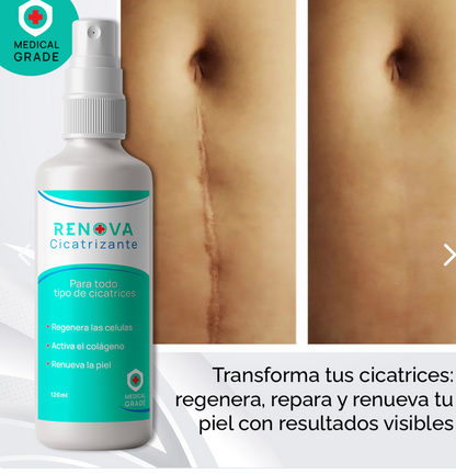 RenovaDerm Spray – Cicatriza Rápido y Natural