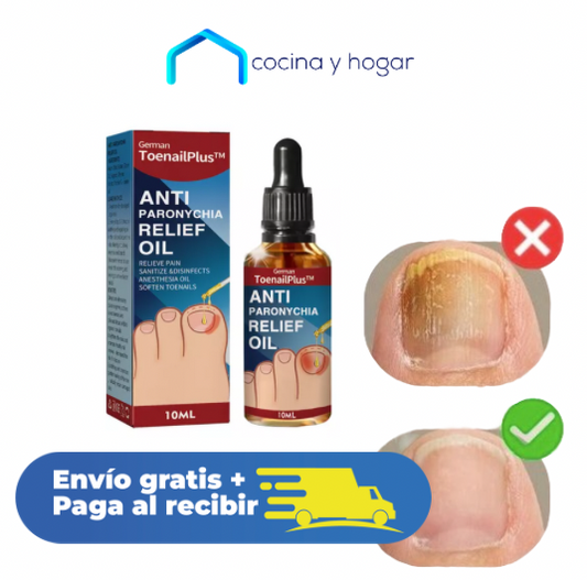 Vitaluñas - Uñas Sanas, Seguras y Sin Hongos