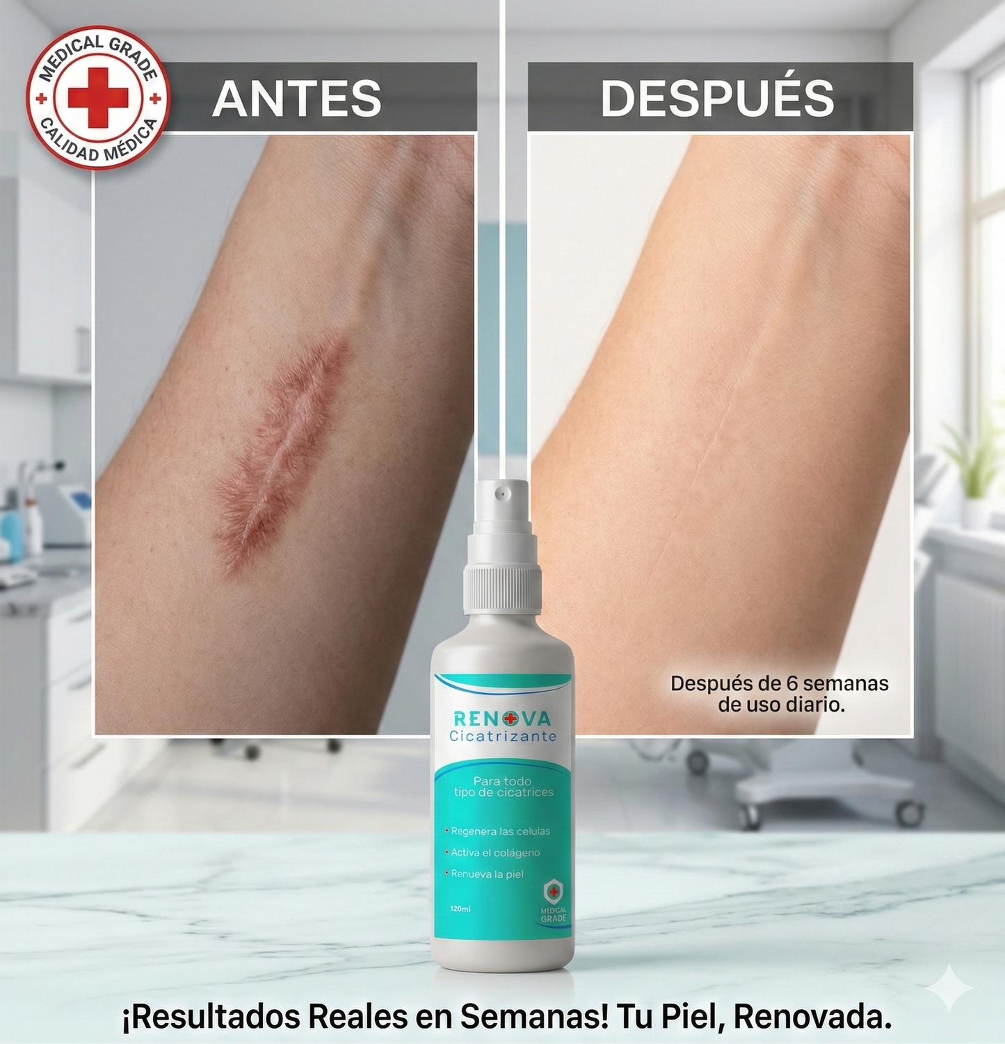 RenovaDerm Spray – Cicatriza Rápido y Natural